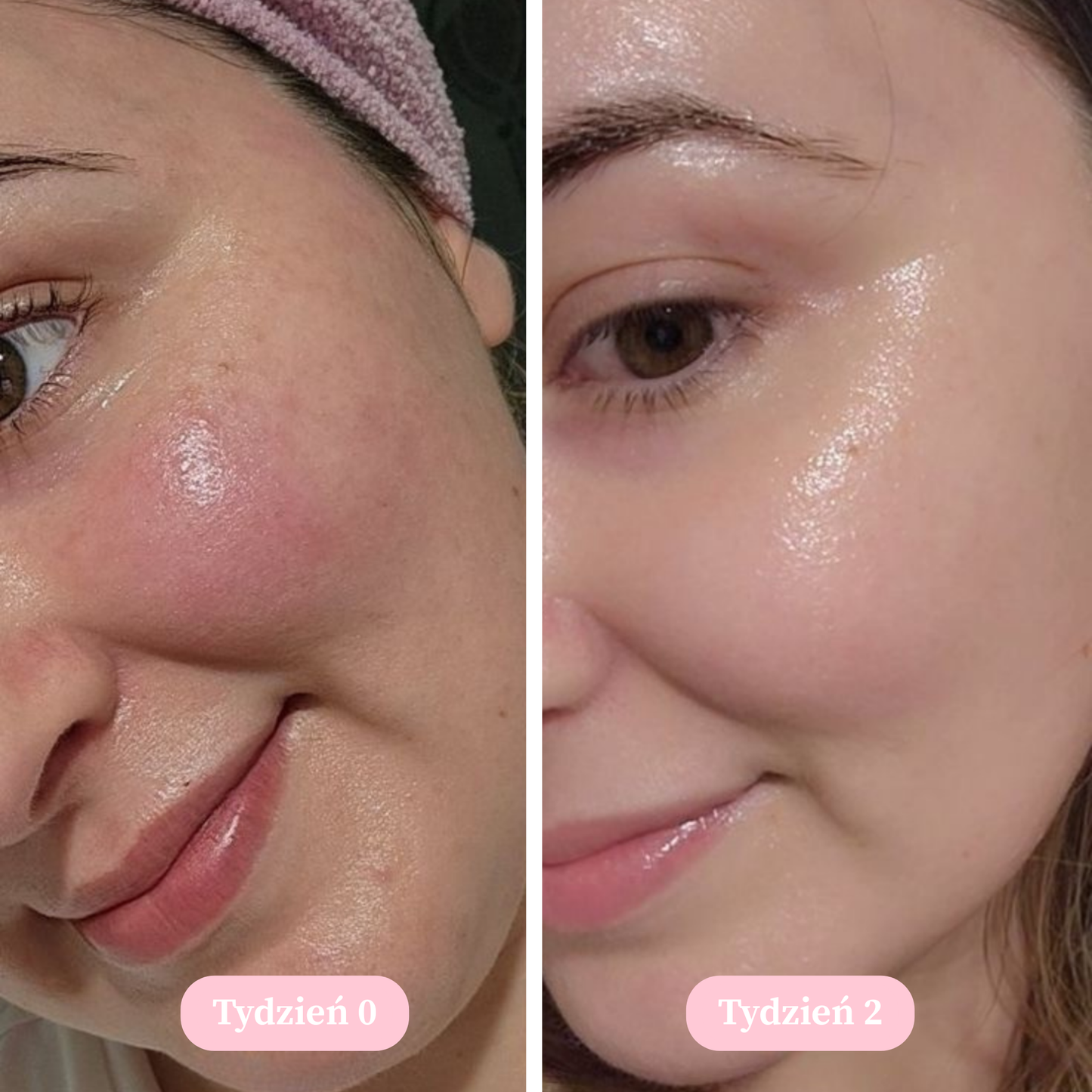 Vellé - Mydło z Kurkumą i Kwasem Kojowym