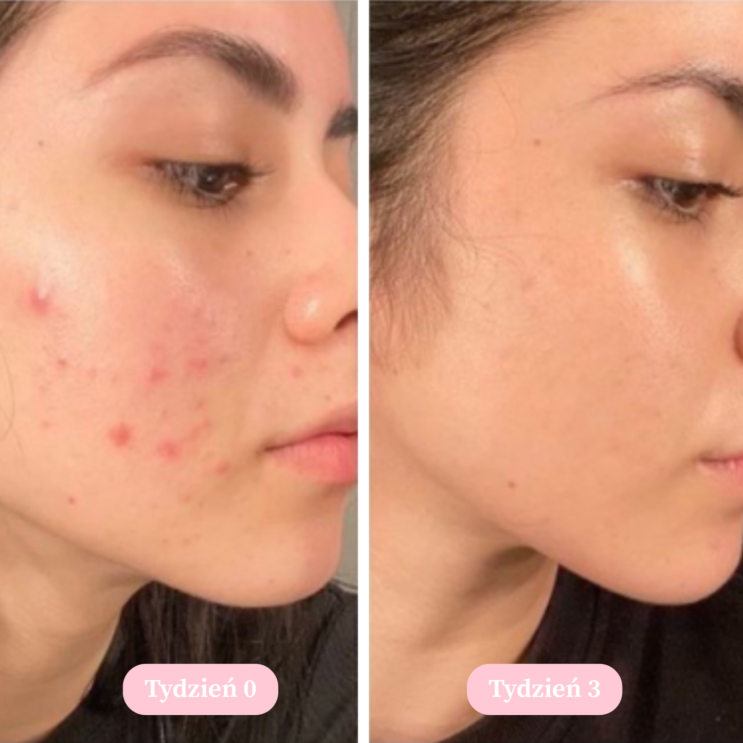 Vellé - Mydło z Kurkumą i Kwasem Kojowym