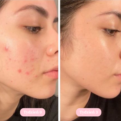 Vellé - Mydło z Kurkumą i Kwasem Kojowym