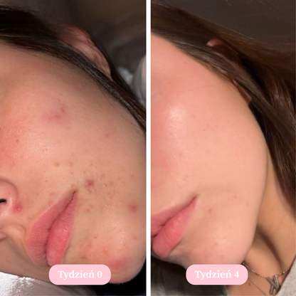 Vellé - Mydło z Kurkumą i Kwasem Kojowym